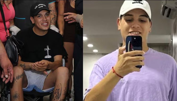 Thiago Medina mostró sus cicatrices y habló del impacto al verse