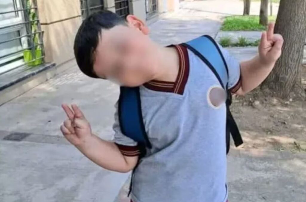 Operaron por sexta vez a Bastián tras el choque en Pinamar