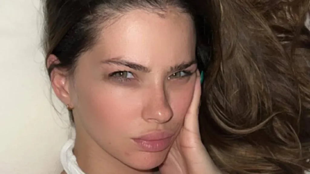 La China Suárez mostró su rostro inflamado desde Turquía y explicó el motivo