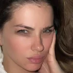 La China Suárez mostró su rostro inflamado desde Turquía y explicó el motivo