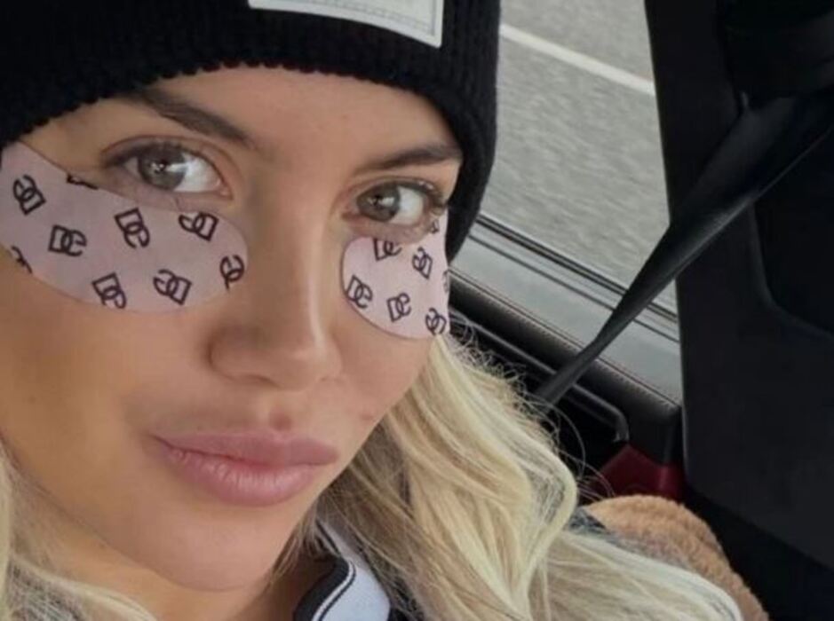 Wanda Nara mostró los parches Dolce & Gabbana de 40 dólares que usa para deshinchar ojeras
