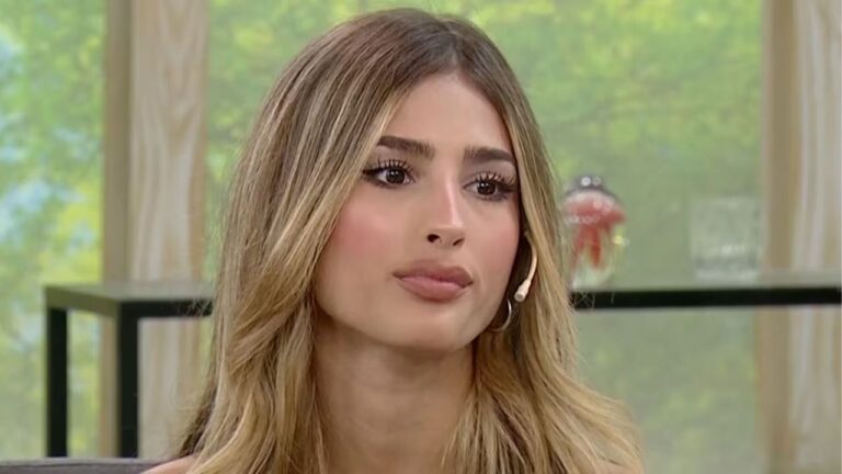 Julieta Poggio sufrió un fuerte accidente en MasterChef Celebrity y mostró cómo quedó su mano: “Me dio mucha impresión”