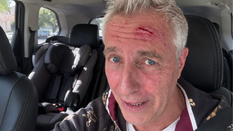 Marley sufrió un fuerte golpe en la cabeza, terminó en el hospital y mostró la herida: “Me rompí la cabeza”